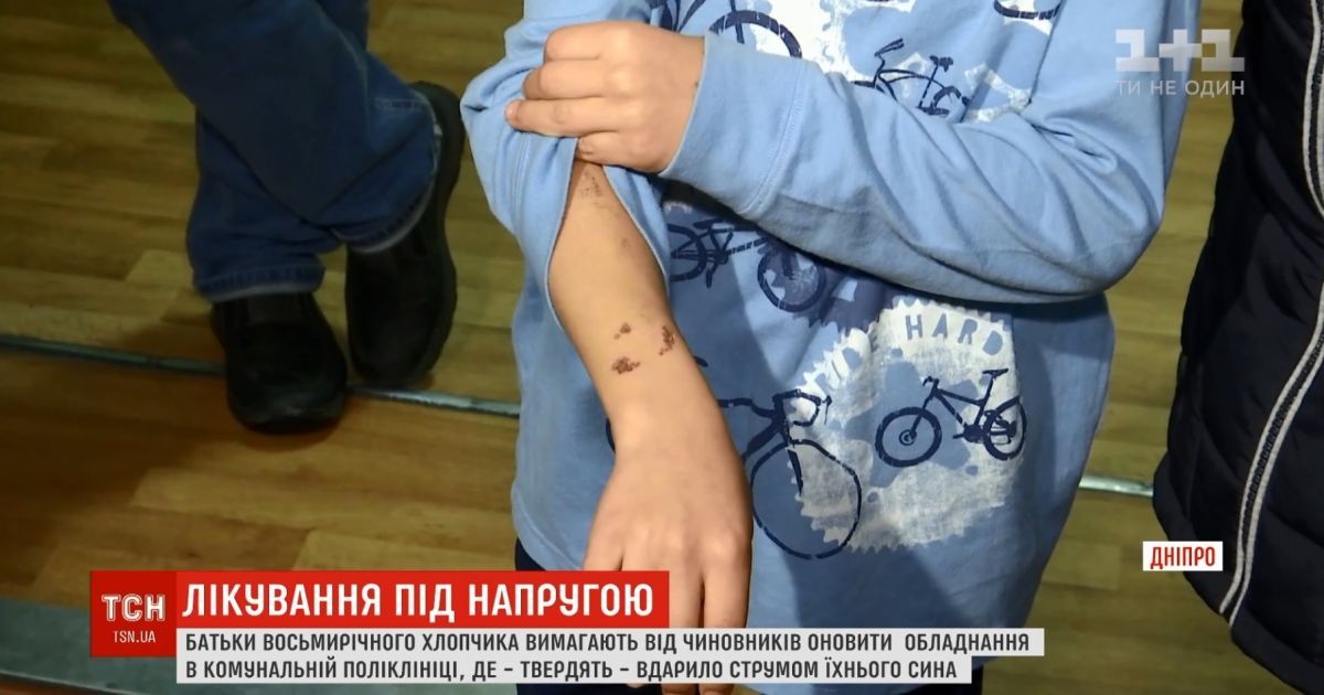 В Днепре школьник получил ожог на процедурах в стоматологической поликлинике