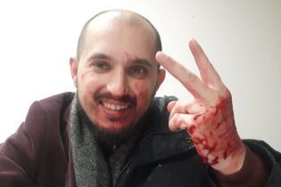 Журналист обвинил охранников Кличко в избиении во время съемки кортежа. Мэр пообещал разобраться