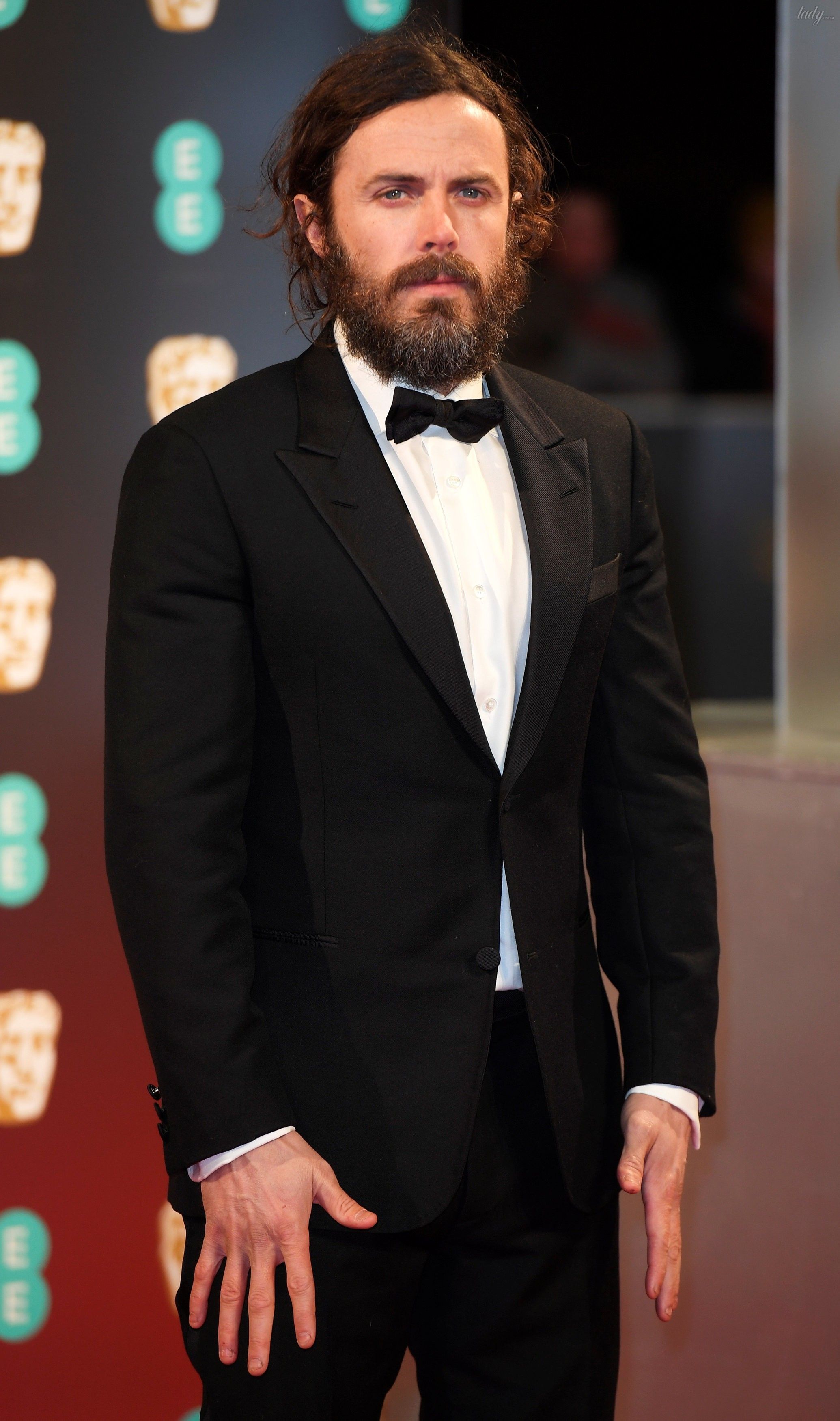 Церемония BAFTA 2017_21
