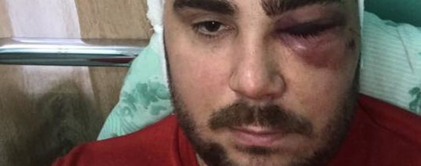 У Запоріжжі впіймали нападника, який прострелив ногу очільнику місцевої "Авто Євро Сили"