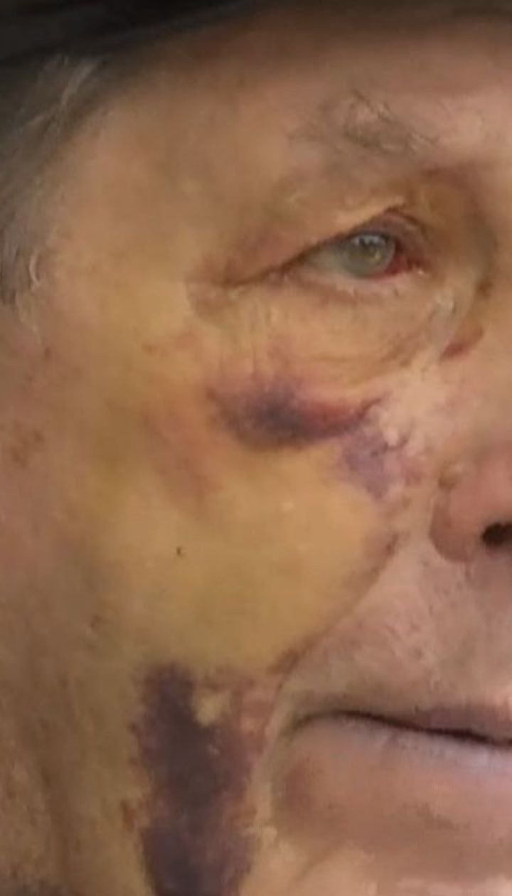 У Києві побили авіаконструктора заводу "Антонов" Віктора Ковальського