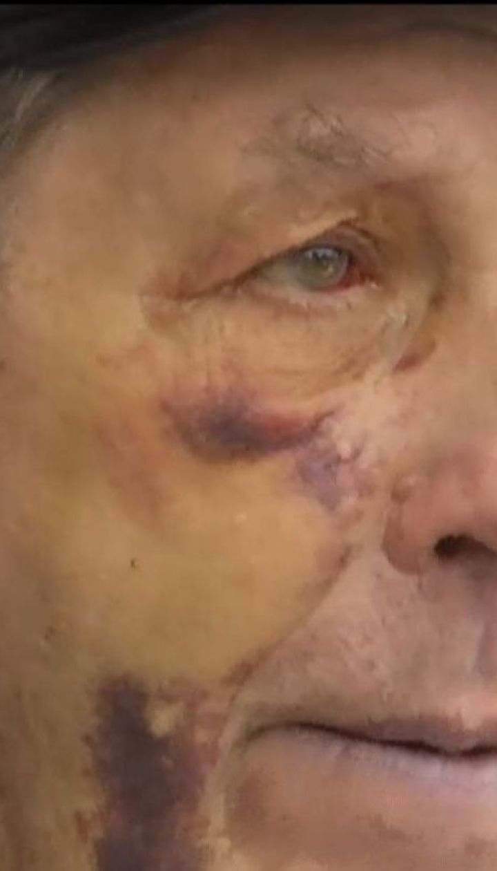 В Киеве избили авиаконструктора завода "Антонов" Виктора Ковальского