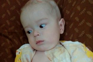 В голівці крихітного Дениска виросла величезна пухлина, яка зміщує мозок