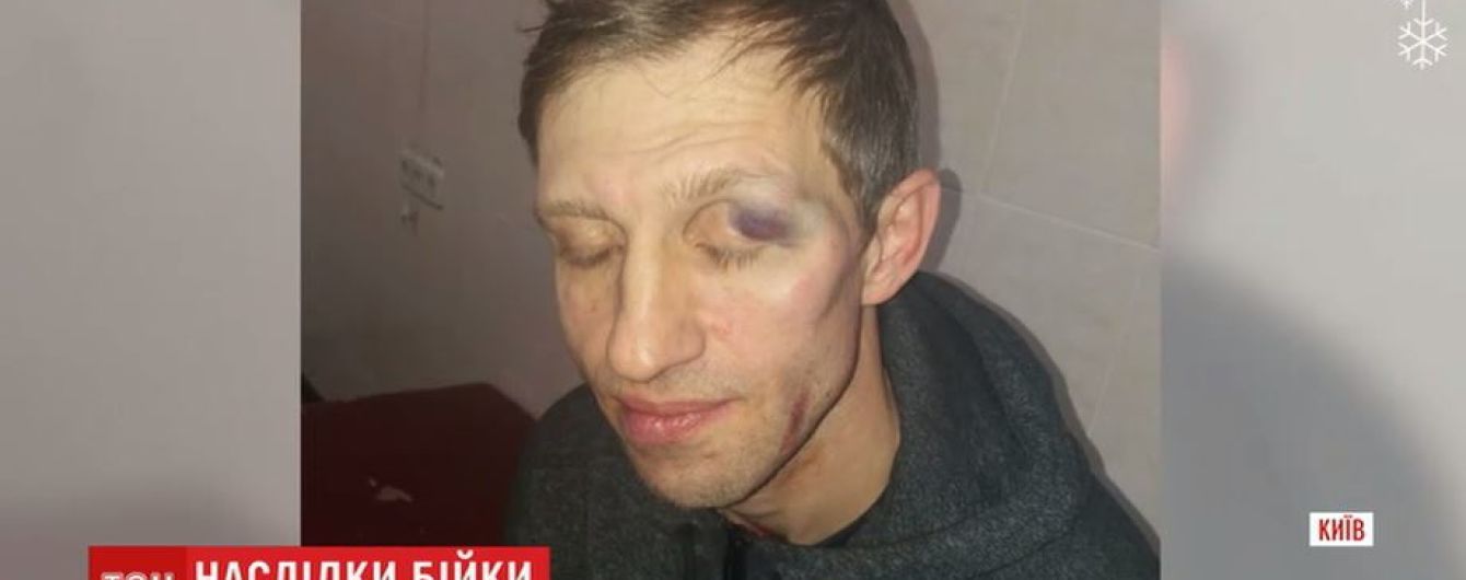 Суд призначив арешт киянинові, котрий жорстоко побив учителя фізкультури