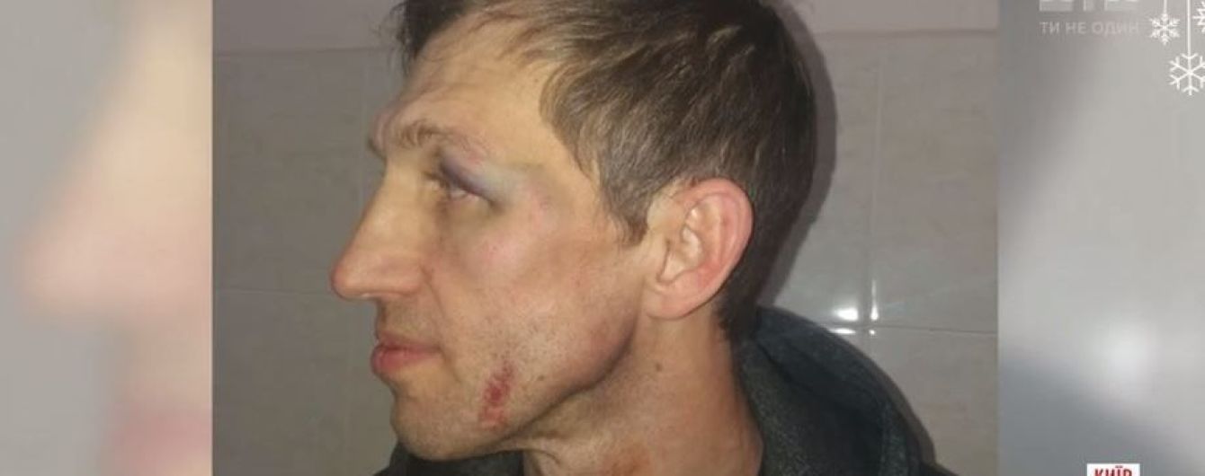 Избитый физкультурник рассказал, чем именно вызывал ярость отца школьника