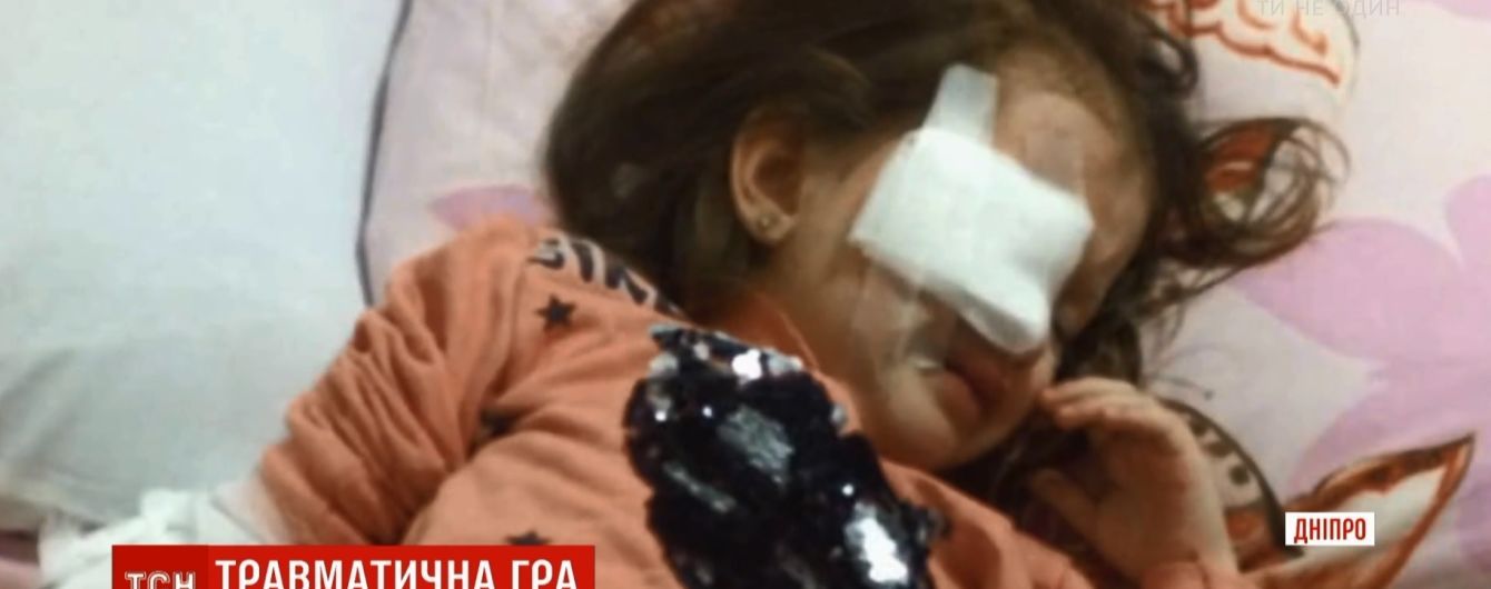 Фиолетовые слезы: в Днепре воспитательница проглядела тяжелую травму 3-летнего ребенка