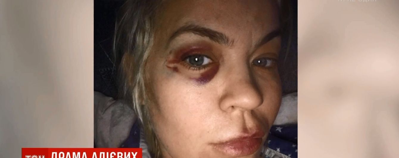 "Сломал кровать о мою голову": бывшая жена футбольной звезды Алиева заявила о новом избиении