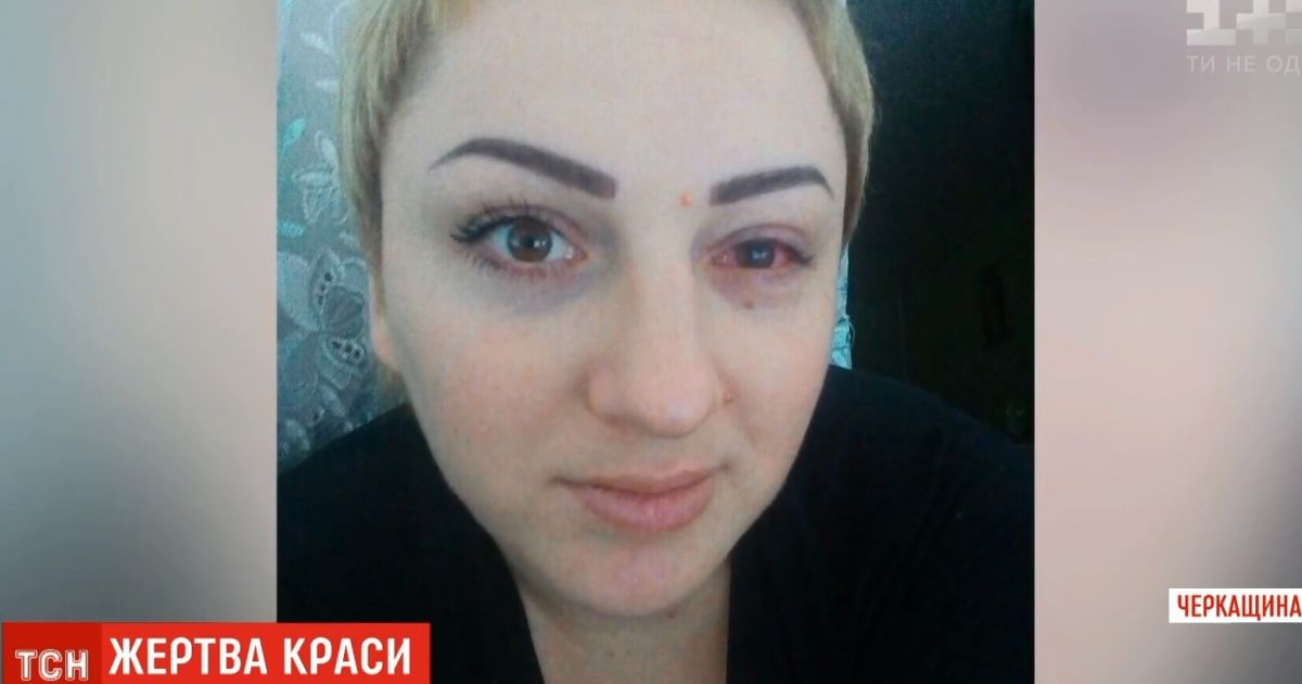 В Умані жінка втратила зір на одному оці після татуажу повік