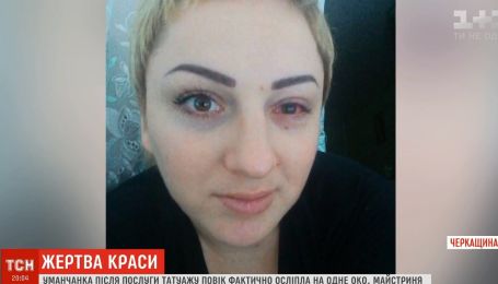 В Умані жінка втратила зір на одному оці після татуажу повік