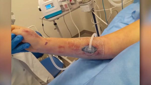 Рука Катерини Тишкевич / © скриншот з відео