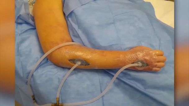 Рука Катерини Тишкевич / © скриншот з відео