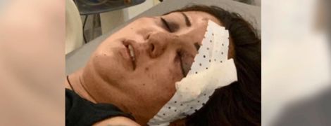 Молодая украинка попала в загадочное ДТП в Камбодже