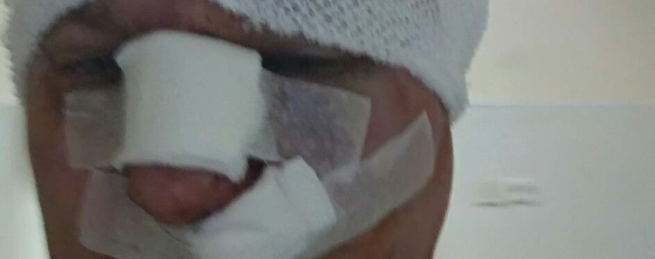 В Киеве избили скандального догхантера Святогора