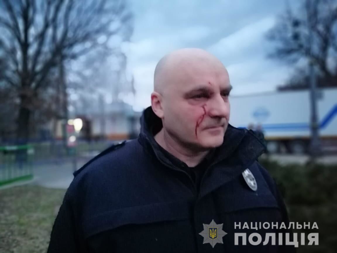 Постраждалий начальник поліції Черкас Лютий
