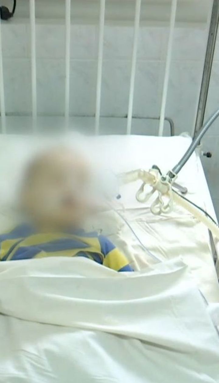 У Кам’янському дворічний хлопчик випав з вікна другого поверху