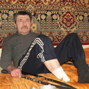 На Сумщине мужчина ампутировал себе ступню и выбросил ее на улицу. Конечность нашла собака