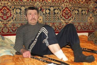 На Сумщині чоловік ампутував собі ступню і викинув її на вулицю. Кінцівку знайшов собака