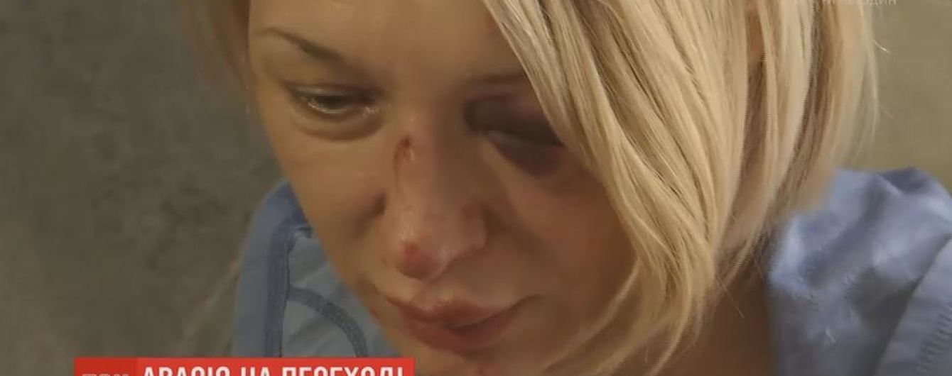 Пострадавшая под колесами маршрутки женщина рассказала подробности аварии