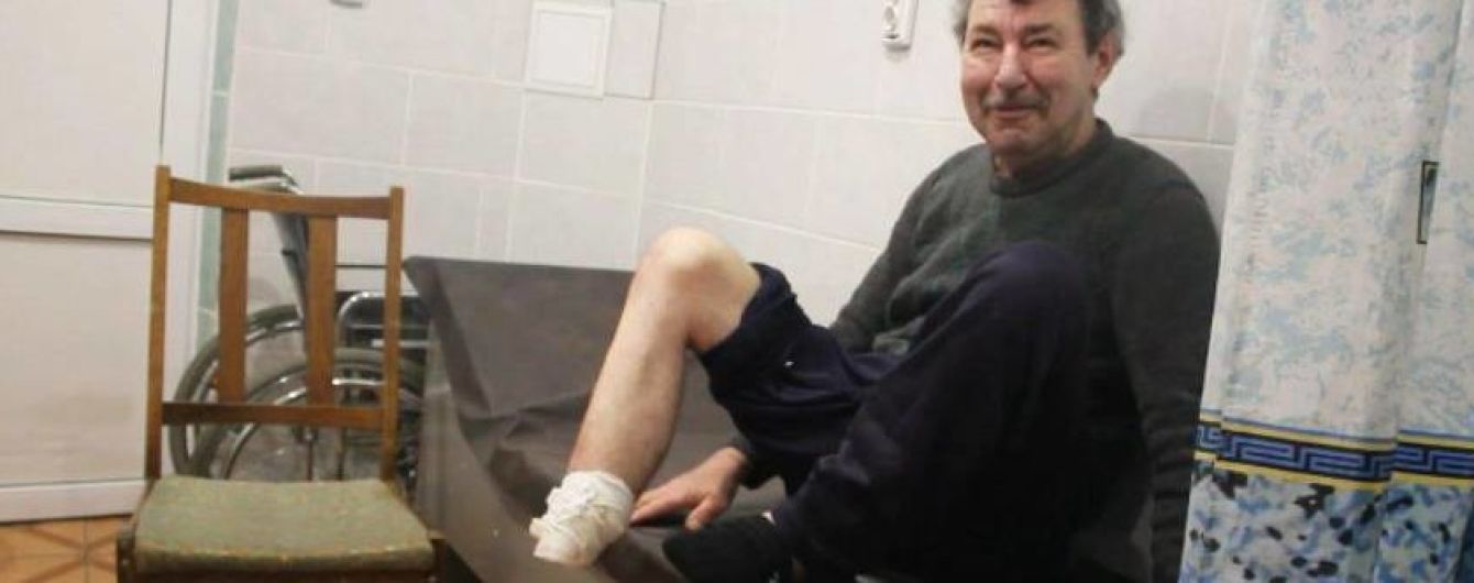 На Сумщині госпіталізували чоловіка, який кухонним ножем ампутував собі ступню і викинув на вулицю