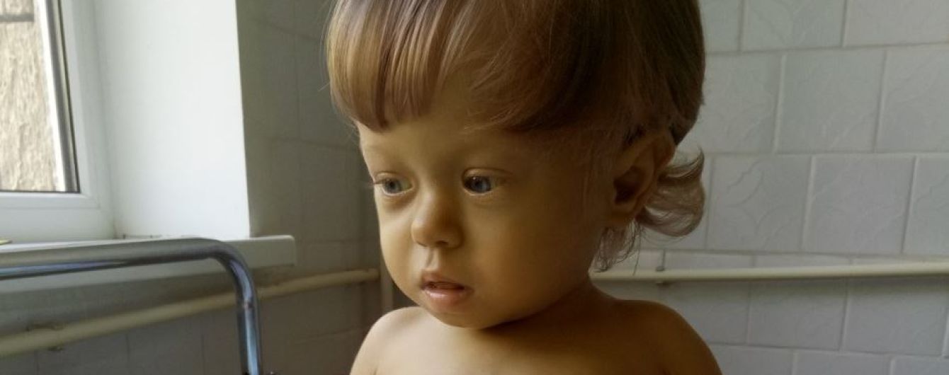 Негайної допомоги потребує Міланка