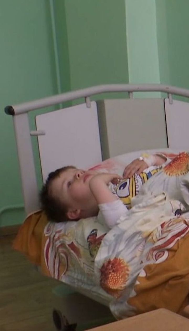 Пітбуль напав на 4-річного хлопчика у Рівному