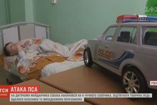 В Ровно питбуль напал на 4-летнего мальчика и порвал ему ногу