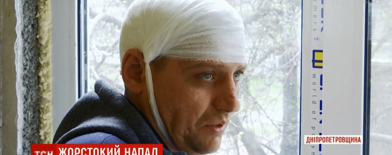 В Каменском неадекватный мужчина избил соседей и четырех копов