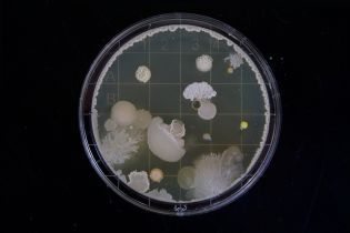Почему "цветет" вода и что является возбудителем ботулизма: смогли бы вы сдать ВНО по биологии? Тест