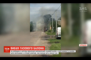На Киевщине в автомобиле взорвался газовый баллон: пострадал 3-летний ребенок