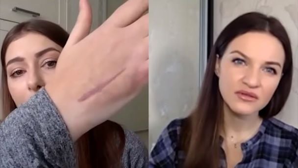 Рука Катерини Тишкевич / © скриншот з відео