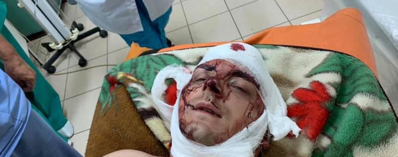 В Конотопе жестоко избили экс-мера и кандидата в депутаты