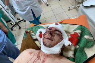 Бывший мэр Конотопа, которого жестоко избили, обвинил в нападении нардепа