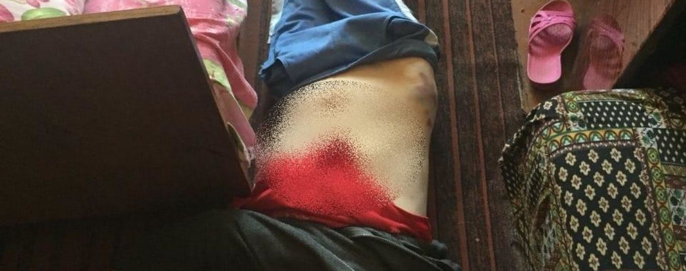 На Киевщине мужчина забил до смерти мать