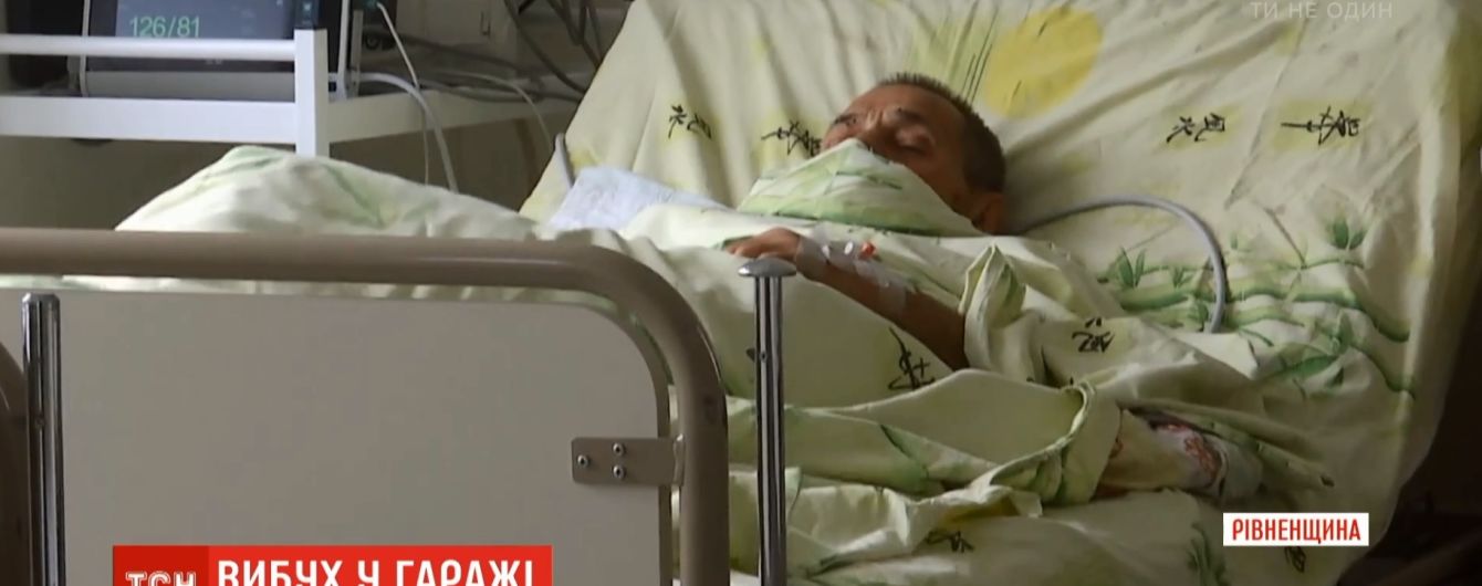 На Ровенщине взрывом в гараже мужчине оторвало руку