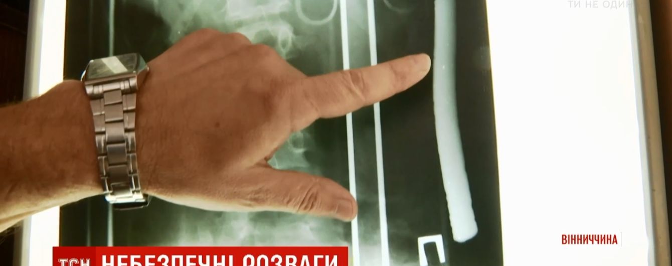 На Винниччине прооперировали 13-летнего парня, который накололся на арматуру во время купания в Днестре