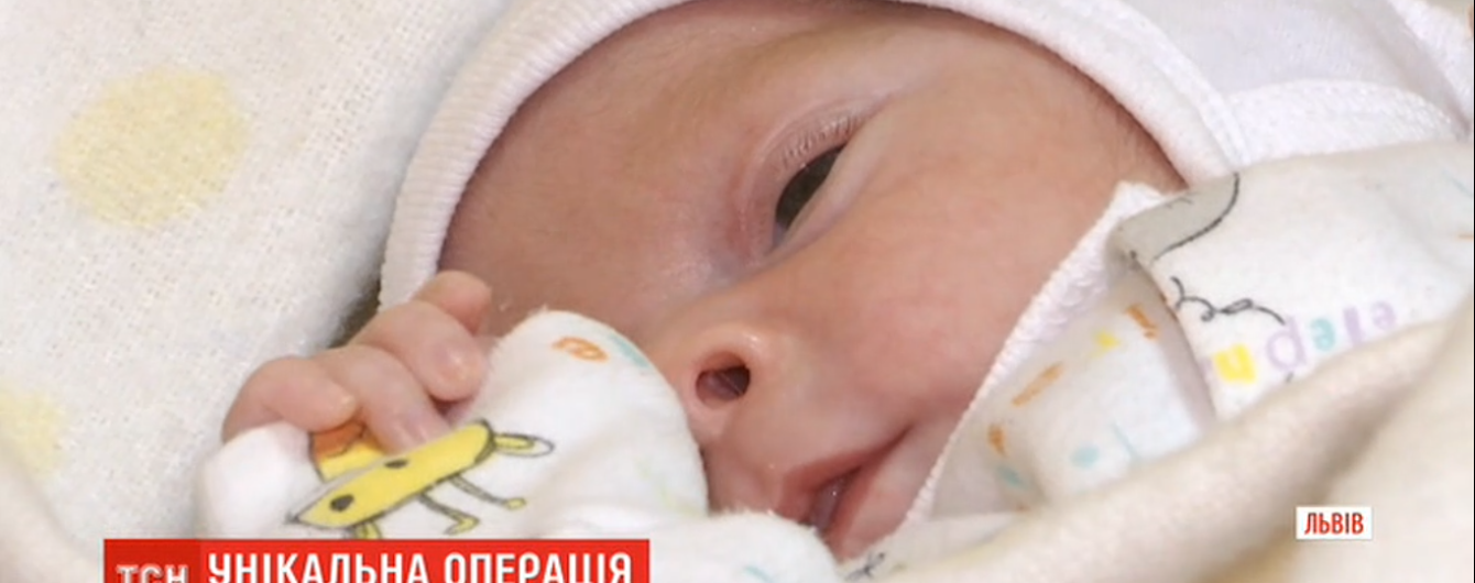 Львівські медики видалили новонародженій дівчинці пухлину-монстра, яка сягала майже 50% маси тіла малюка