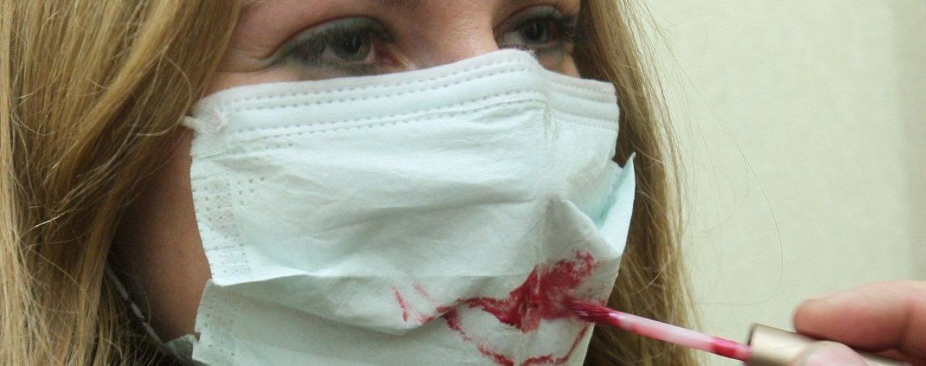 Не целоваться и воздержаться от секса. Супрун посоветовала, как лечить герпес на губах и гениталиях
