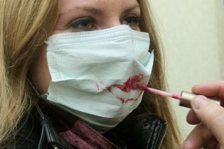 Не целоваться и воздержаться от секса. Супрун посоветовала, как лечить герпес на губах и гениталиях