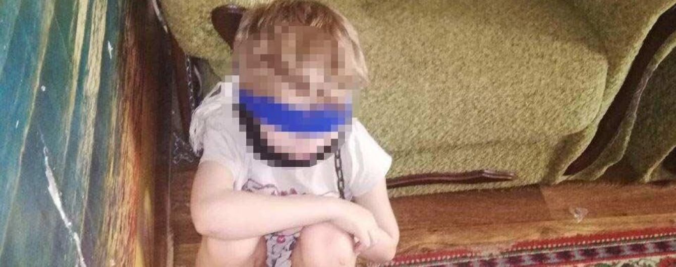 В Днепре опекунша посадила 8-летнего мальчика на цепь