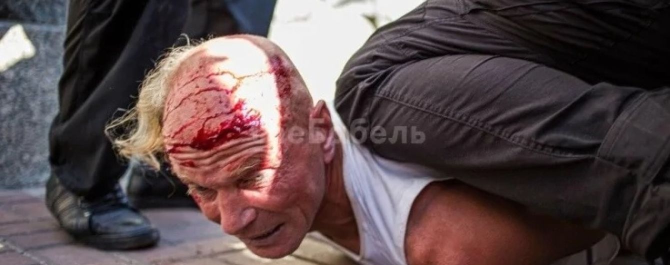 Ветерана, який заліз на огорожу на Майдані під час виступу Зеленського, побили та затримали правоохоронці