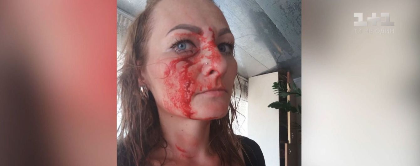Царапины, ушибы и поливание водой. На Тернопольщине между матерями вспыхнул конфликт из-за детей