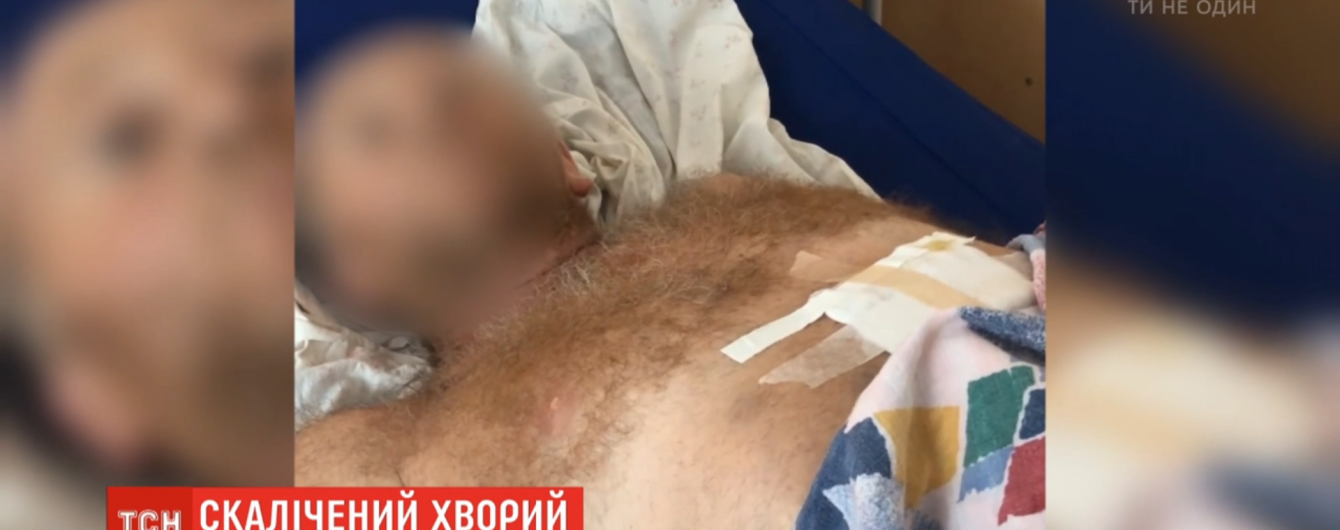 В психиатрическо-наркологической больнице в Глевахе избили пациента: ему удалили селезенку и мочевой пузырь