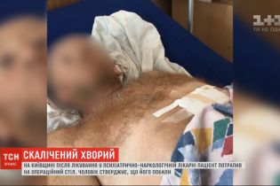 В психиатрическо-наркологической больнице в Глевахе избили пациента: ему удалили селезенку и мочевой пузырь