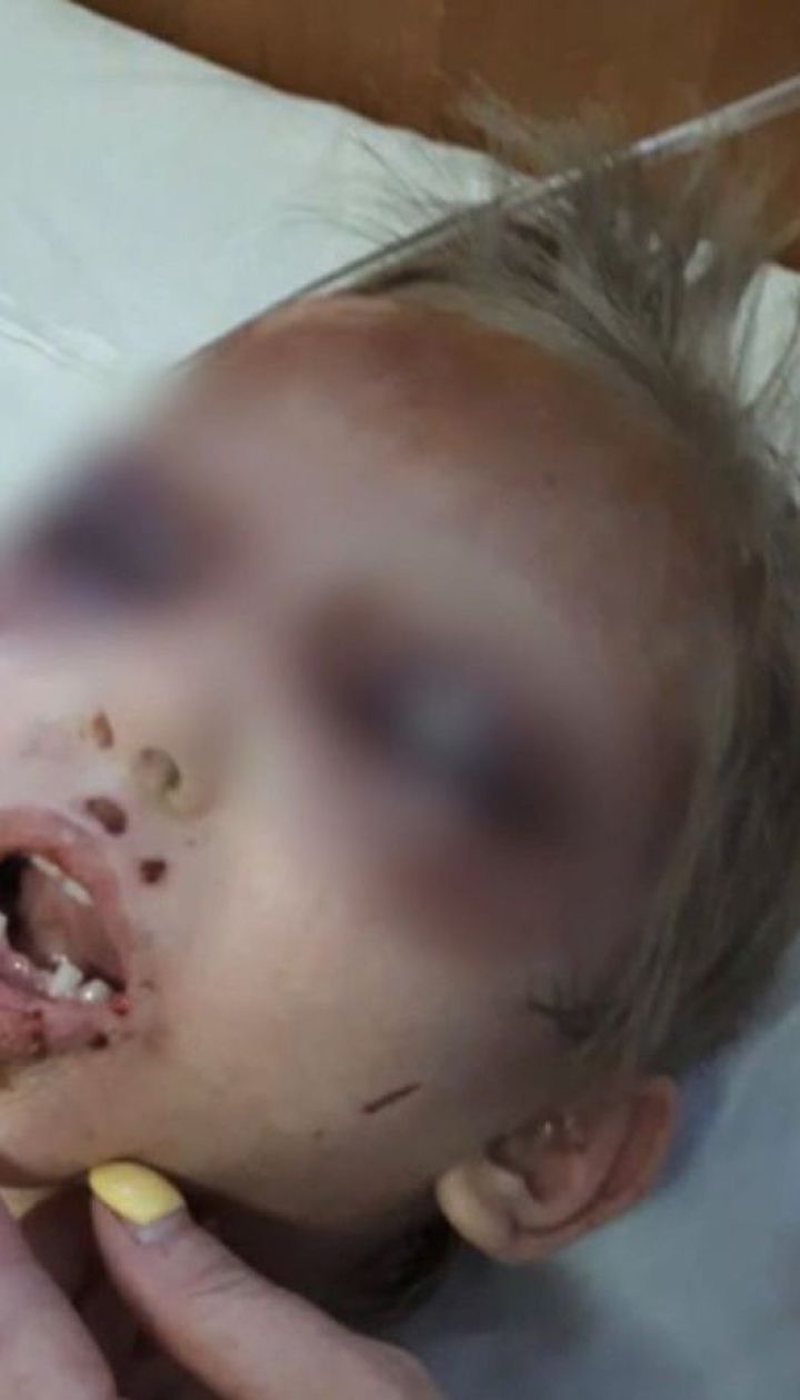 Била, колола голками та морила голодом – названа мати катувала всиновленого сина