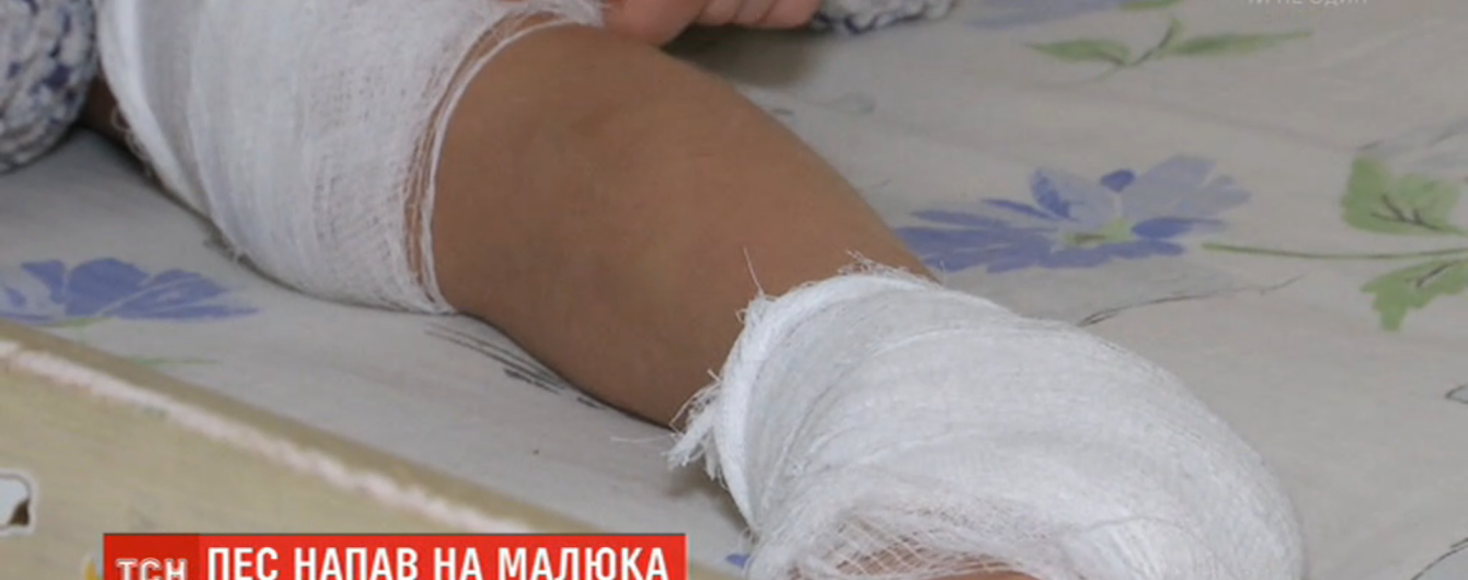 В Киеве пес набросился на пятилетнего мальчика: у ребенка разорванное колено и пятка