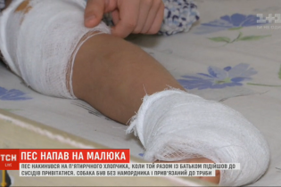 В Киеве пес набросился на пятилетнего мальчика: у ребенка разорванное колено и пятка