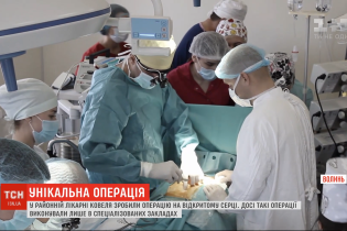 В Ковеле хирурги провели операцию на открытом сердце мужчине, у которого случился инфаркт