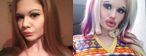 Болгарка сделала 15 хирургических операций. Теперь она мечтает о самых больших губах в мире