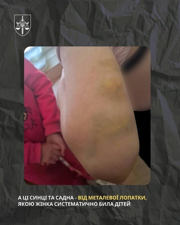 На Полтавщині судитимуть опікунку за катування молодших сестер. / © Офіс Генерального прокурора