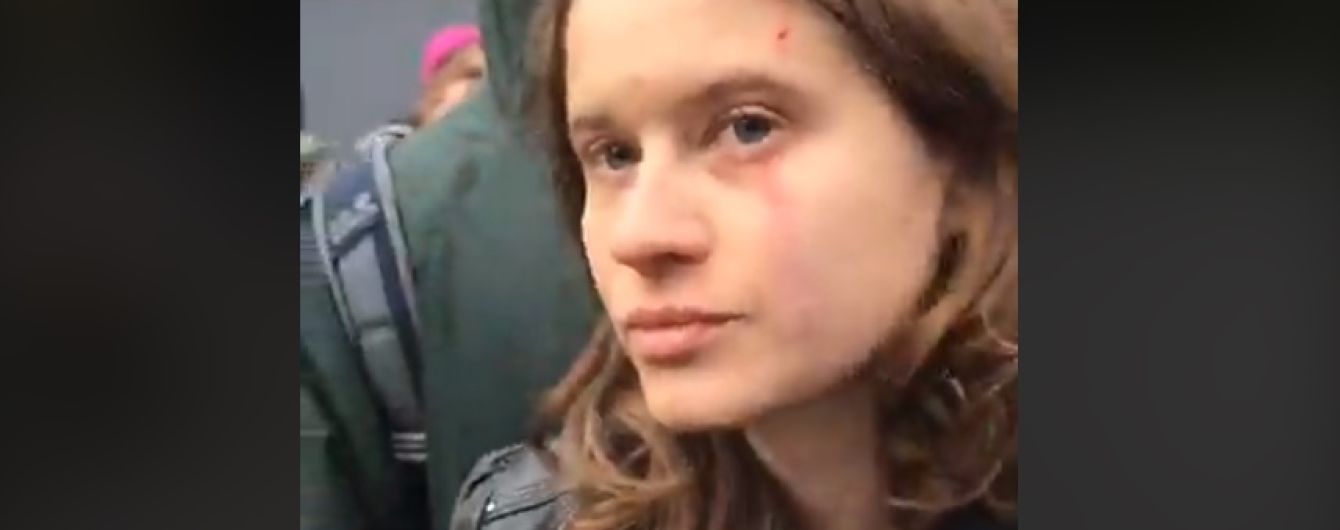 На акции под посольством Турции в Киеве ударили по лицу активистку